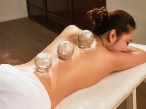 Cupping